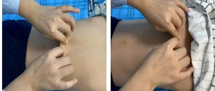 鼻炎防治有妙招（三）| 减少小儿鼻炎复发，快来试试这些中医外治法！