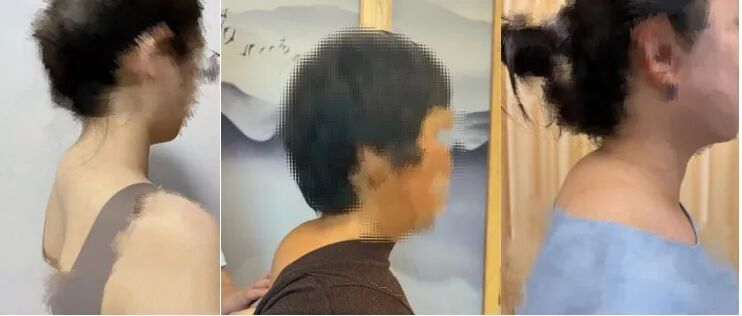 如何让“富贵包”塌方？中医正骨还您挺拔气质