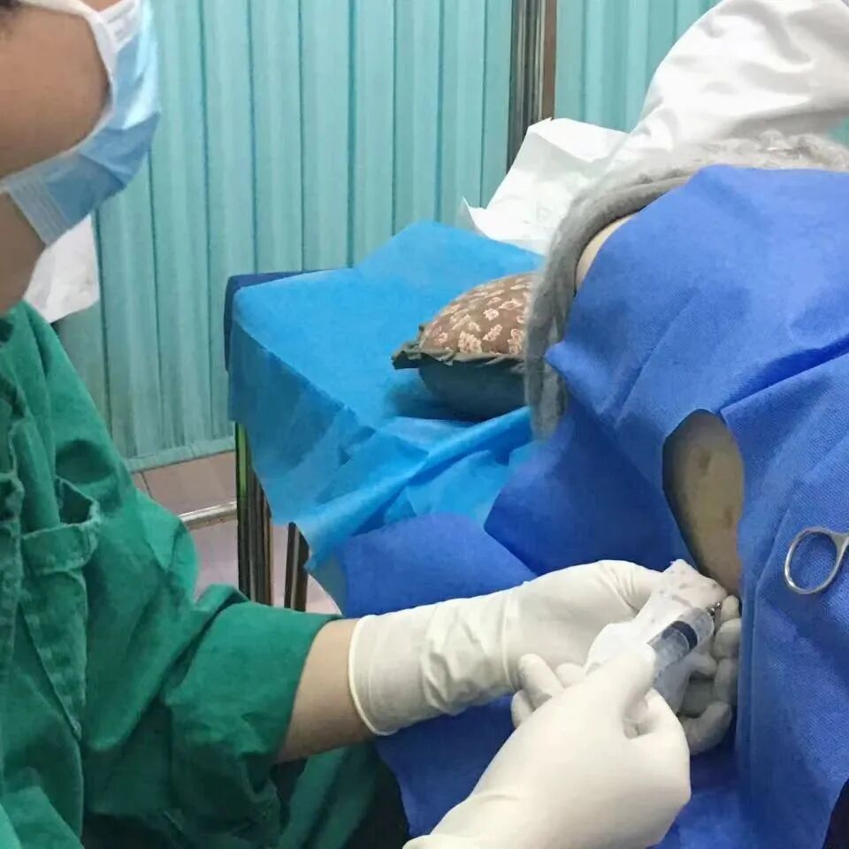 这项儿科常规检查，真的不会把娃变傻