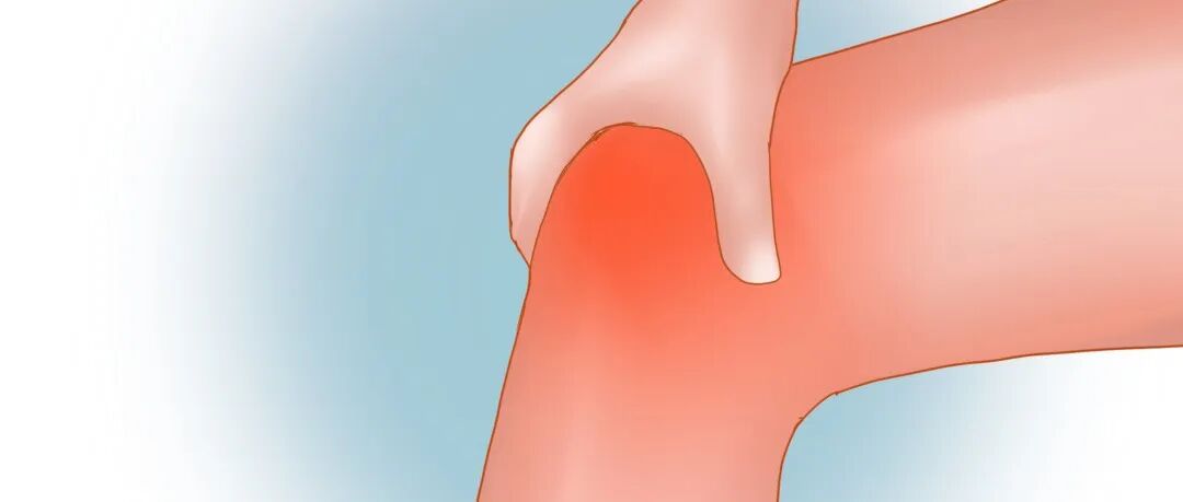 夜晚的“隐形困扰”——不宁腿综合征